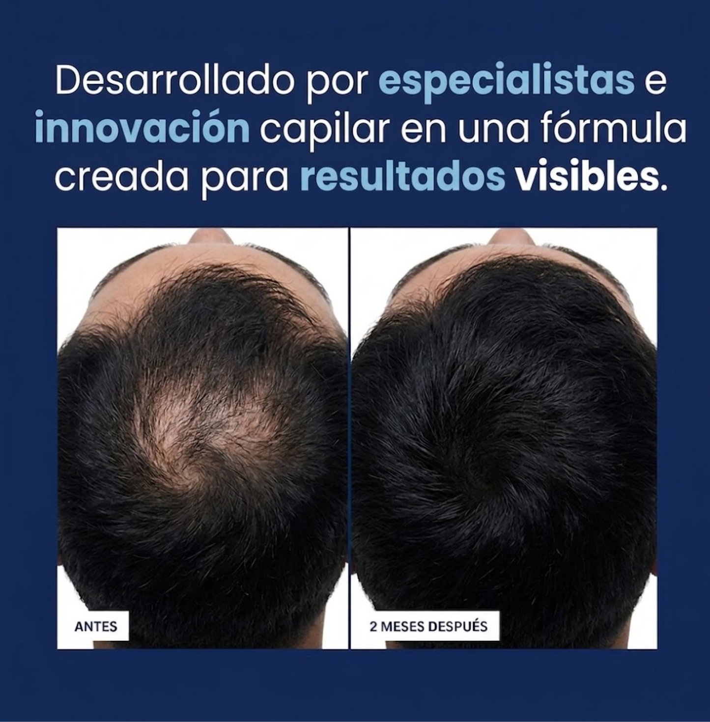 Badmise Sérum Capilar: Multiplica el Volumen de tu Cabello desde la Raíz.